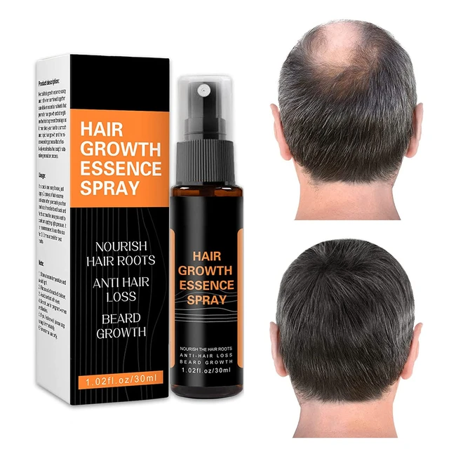 Densanti Hair Regrowth Spray - Rapid Growth Treatment for Men and Women - Natural Ingredients to Repair Hair Follicles - 30ml