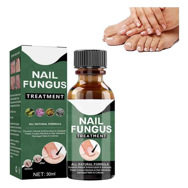 Antifungal Nail Treatment - Repair & Renew Damaged Nails